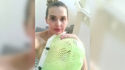 Mały guzek okazał się rakiem. Kobieta myślała, że po prostu ugryzła się w język