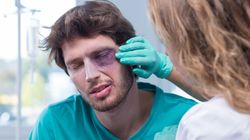 Podbite oko - jak wygląda i kiedy znika? Domowe sposoby leczenia