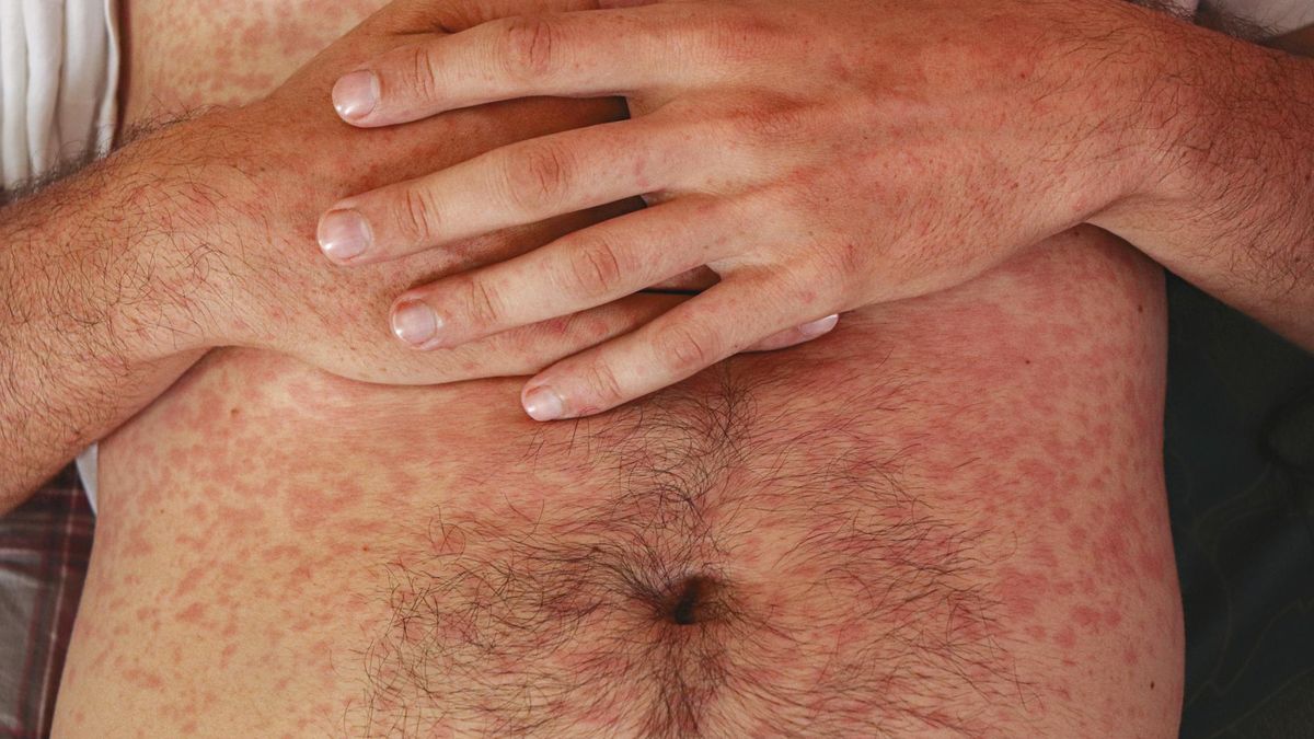 Najważniejsze ognisko zachorowań koncentruje się w hrabstwie Spartanburg