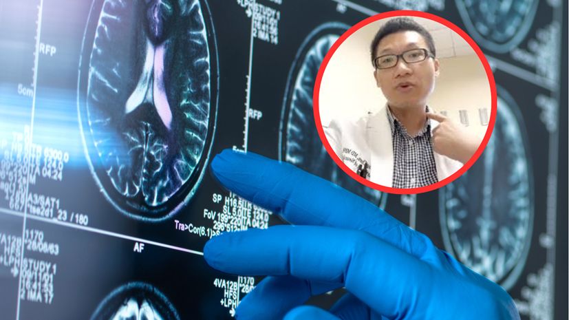 6 sposobów na obniżenie ryzyka demencji według neurologa