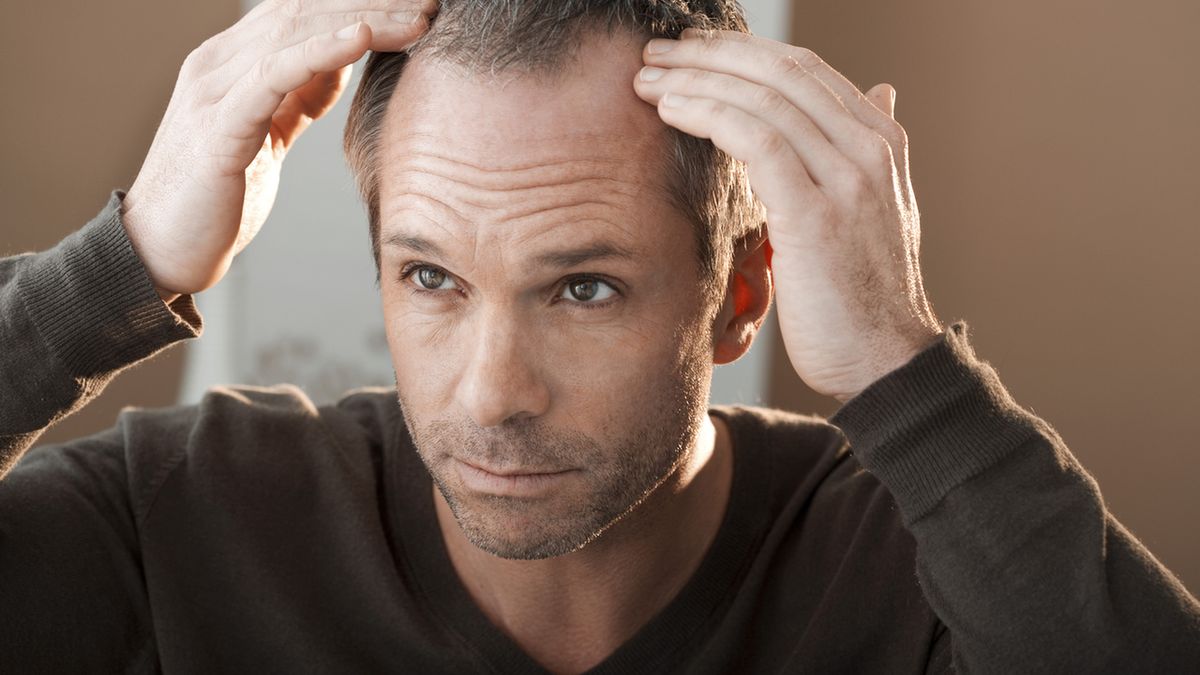 Alpicort E to płyn leczniczy na skórę, stosowany w przypadku łysienia.