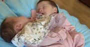 Brytyjska para przywitała na świecie bliźniaczki, które ''ciągle się przytulają''
