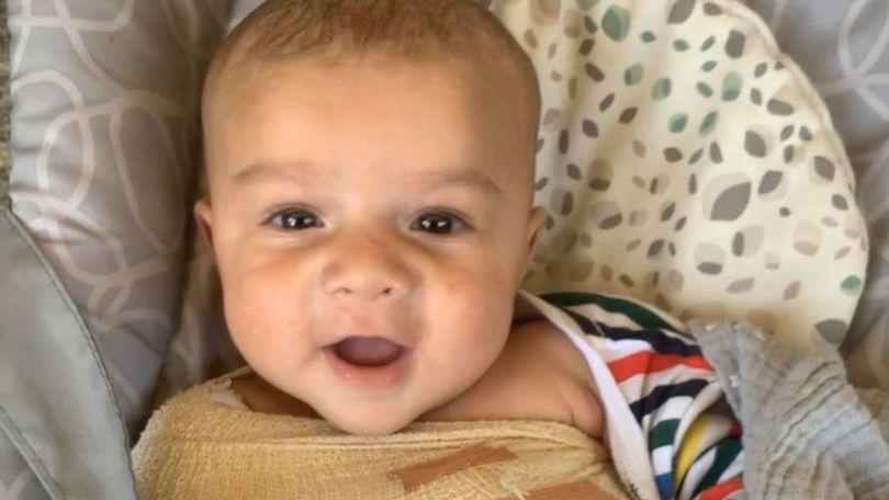 Niemowlę trafia do szpitala z poważnym złamaniem. Skoczył na nie pies