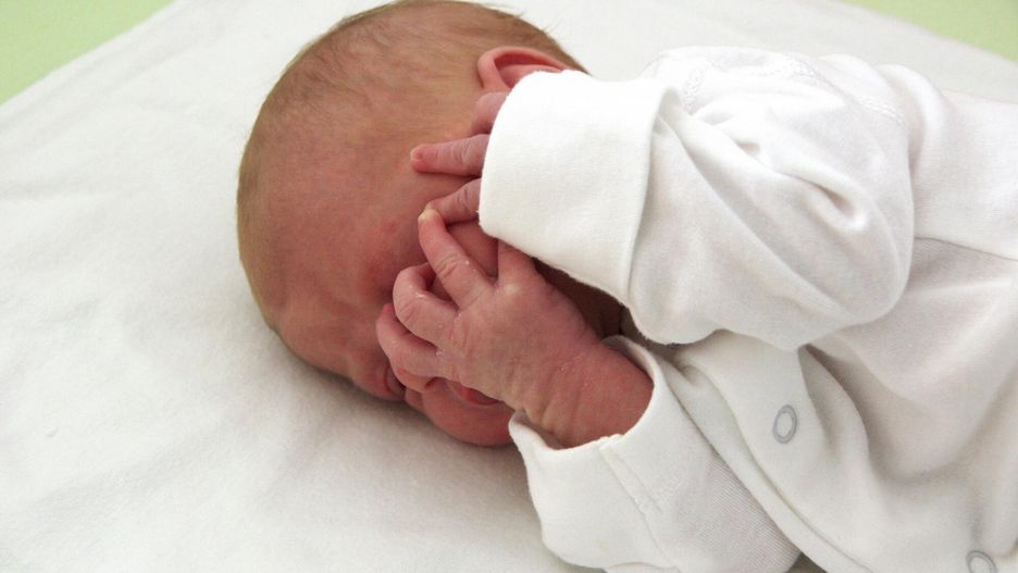 Dziwny blask w oku dziecka był objawem groźnego raka