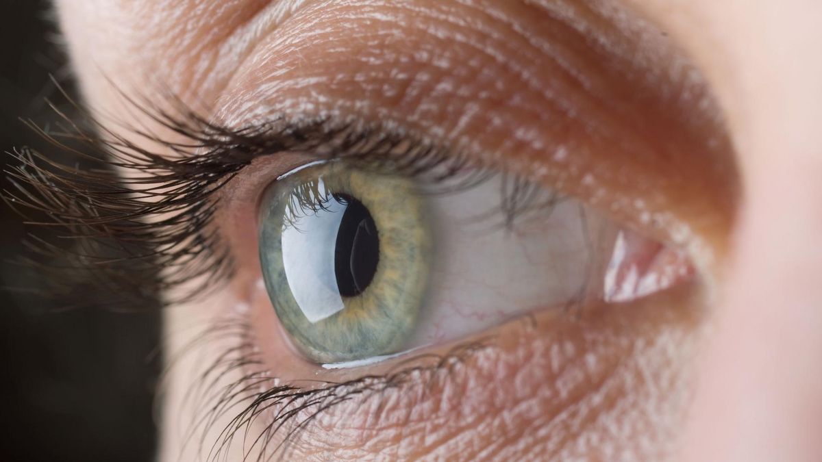 Czym jest gradówka?