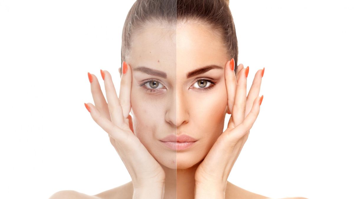 Plamy na twarzy. Dlaczego powstają i jak się ich pozbyć?