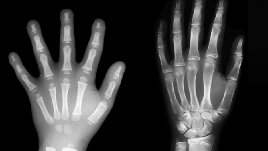 Dłoń przedszkolaka nie jest w pełni ukształtowana. Różnice w rozwoju widać gołym okiem