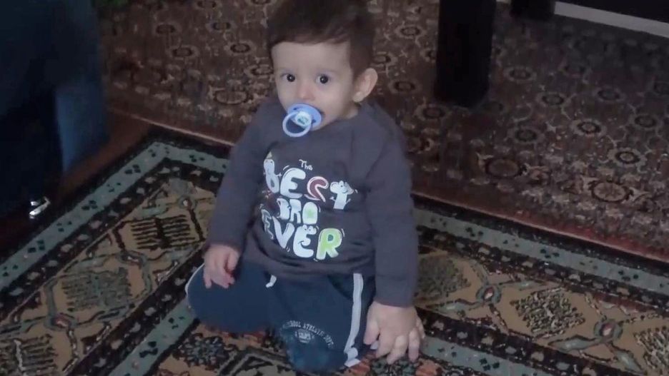 18-miesięczny chłopiec cierpi na zespół Klippla-Trénaunaya