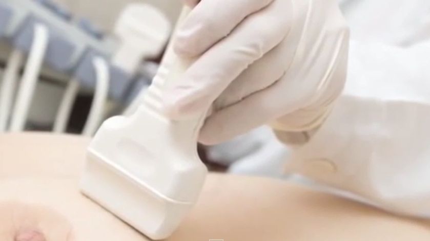 Rak piersi to nadal najczęstsza przyczyna śmierci wśród kobiet 