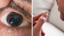 Przełom w leczeniu jaskry na skalę światową. Prace nad tabletką trwały 20 lat