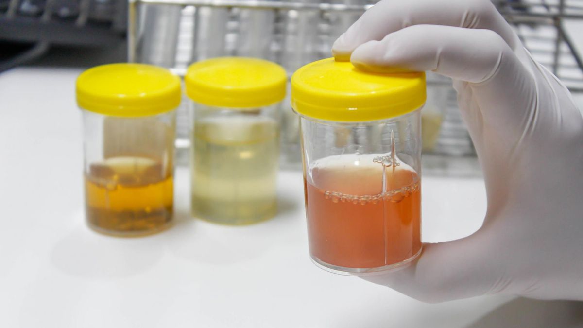 Erytrocyty w moczu w ciąży