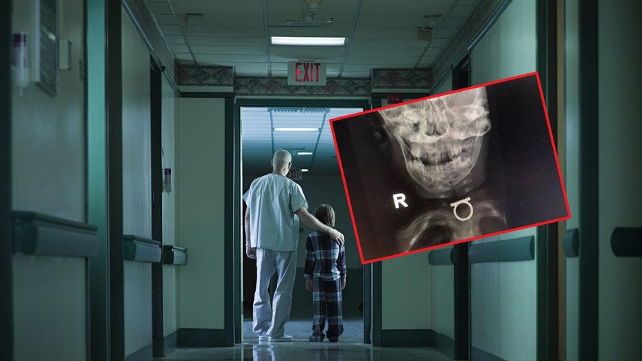 2-latek nie chciał jeść. Okazało się, że połknął pierścionek