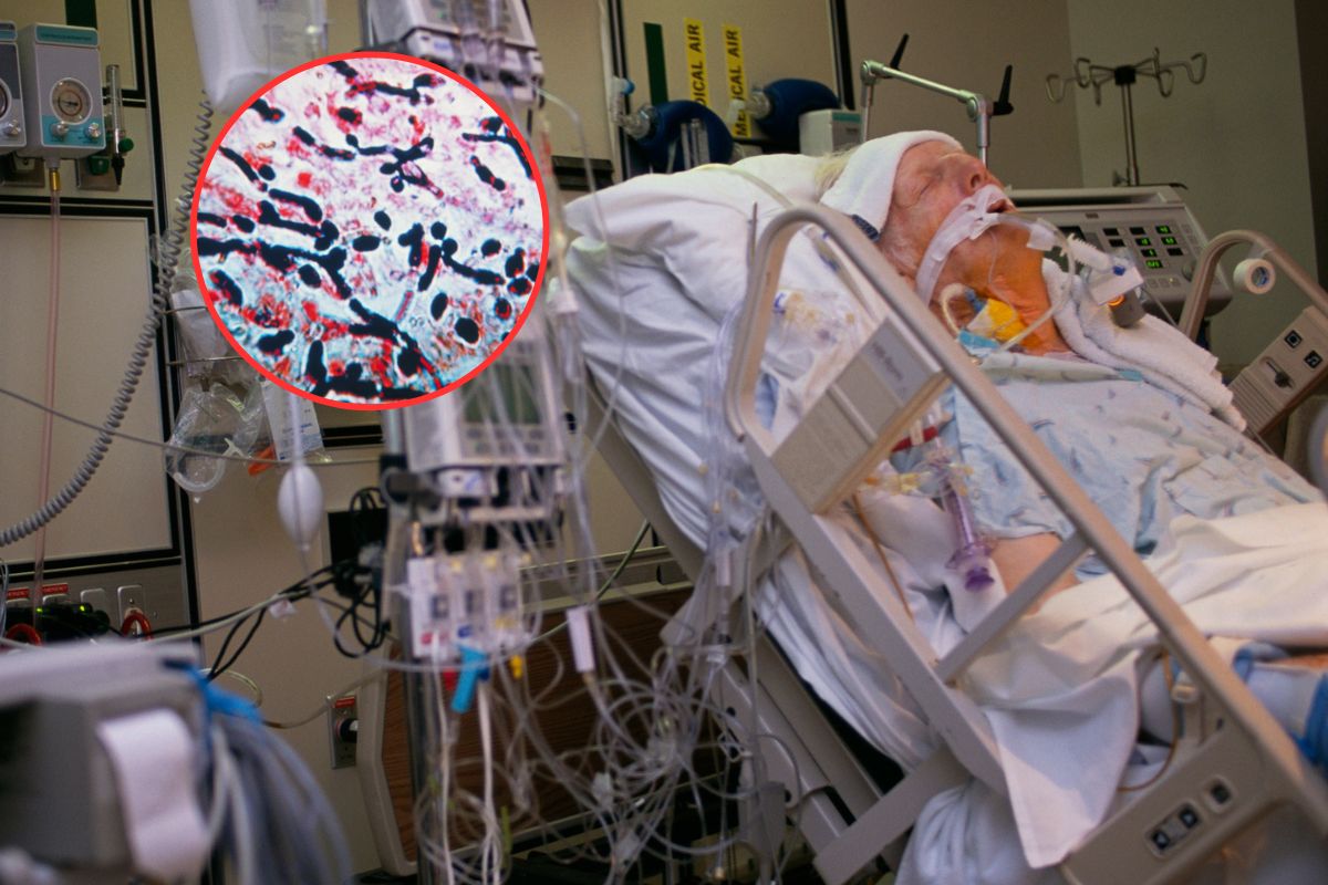 Nawet 100 tys. pacjentów rocznie. Zakażenia mogą prowadzić do sepsy