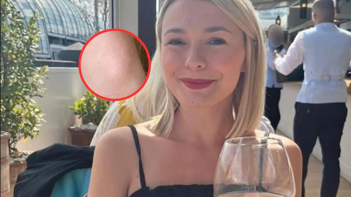 Mama dwójki dzieci odczuwała ból za uchem po wypiciu alkoholu. To był już objawy choroby