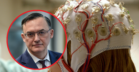 Udary u coraz młodszych Polaków. Neurolog mówi, jak zadbać o mózg