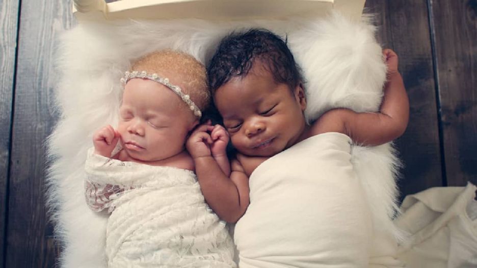 Nie wierzyła własnym oczom, gdy ujrzała bliźnięta tuż po narodzinach. Tak wyglądają dziś