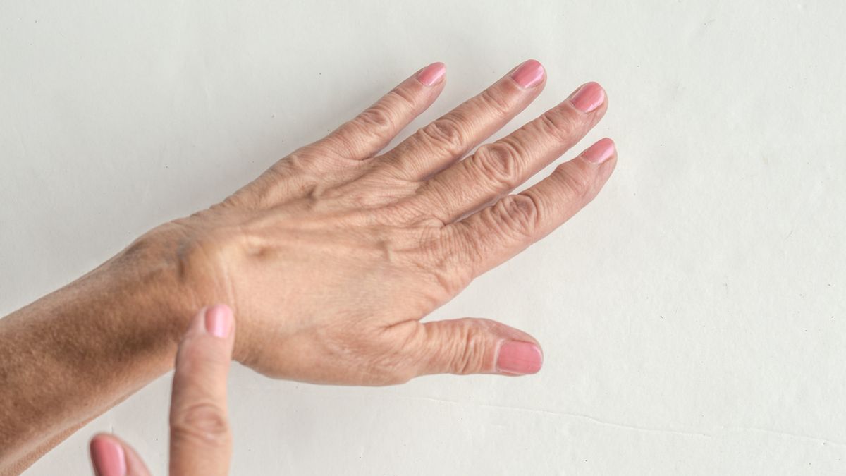 Usuwanie ganglionów polega na nakłuciu i odessaniu z niego płynu.