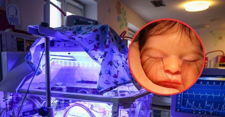 Lekarz pokazał zdjęcie dziecka. To nie jest fotomontaż