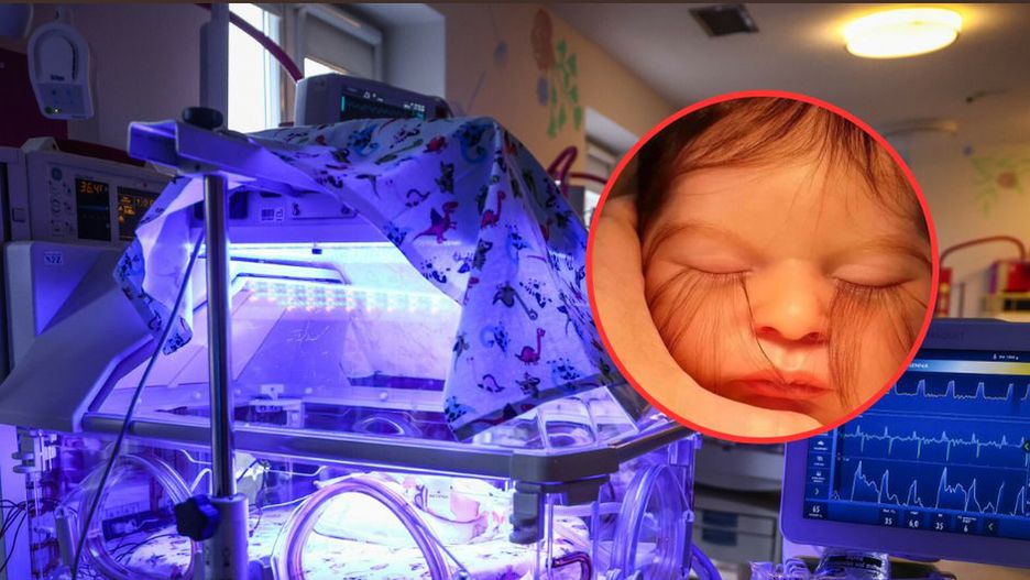 Lekarz opublikował zdjęcie dziecka. Takie rzęsy mogą oznaczać chorobę