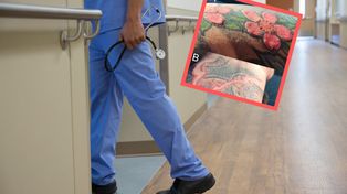 Reakcja alergiczna wymknęła się spod kontroli. Winny był czerwony tusz do tatuażu