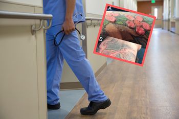 Reakcja alergiczna wymknęła się spod kontroli. Winny był czerwony tusz do tatuażu