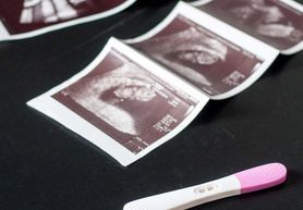 Aborcja możliwa dzięki zaświadczeniu od psychiatry. Wady letalne płodu mogą powodować uszczerbek na zdrowiu psychicznym 