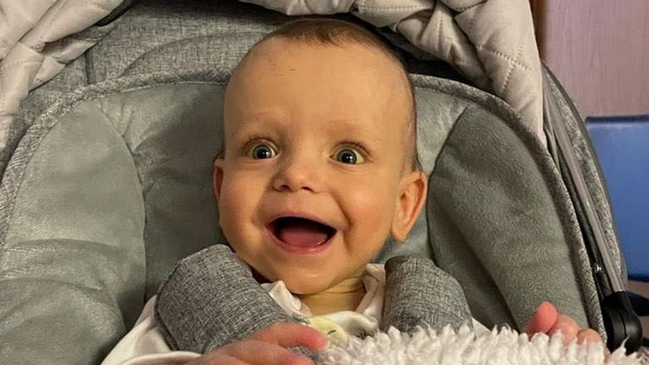 Narządy tego dziecka są poza ciałem. "To tykającą bomba"