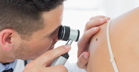 Dermatoskopia (badanie dermatoskopowe) - wskazania, zastosowanie, przebieg