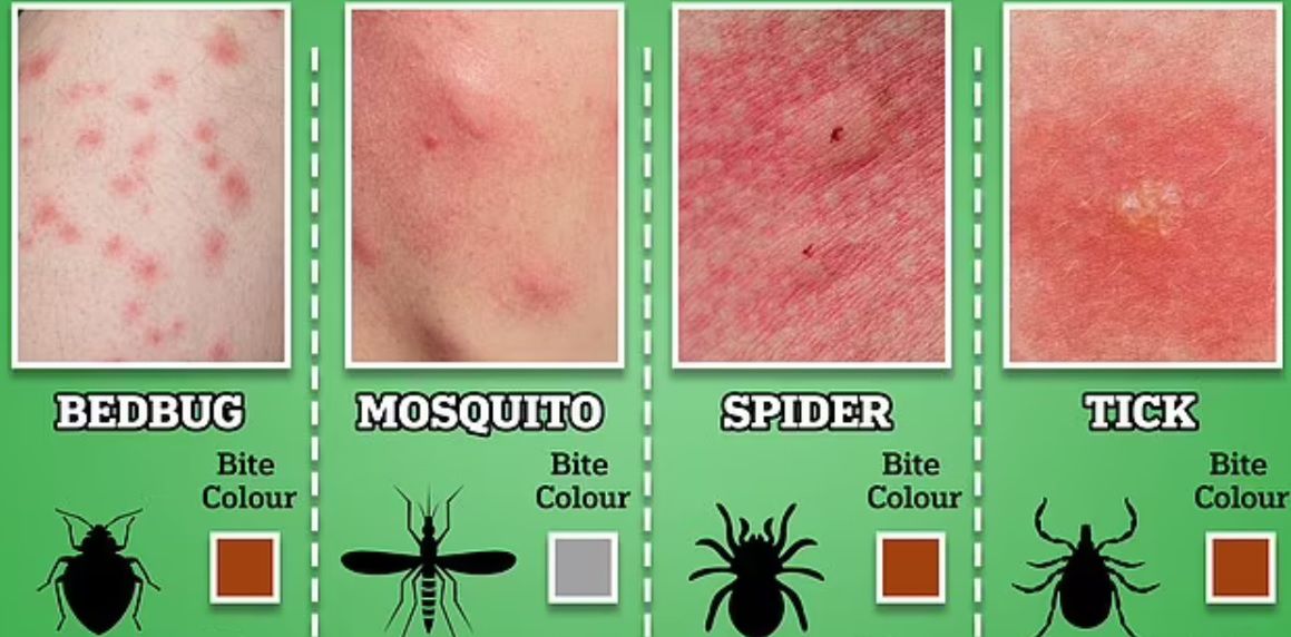 Jak wygląda ukąszenie przez pluskwy?