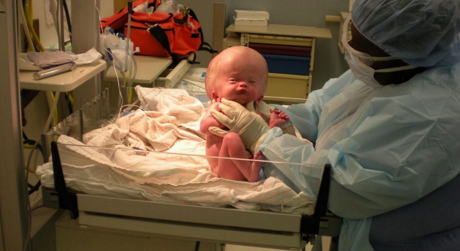 Chłopiec miał niewielkie szanse na przeżycie