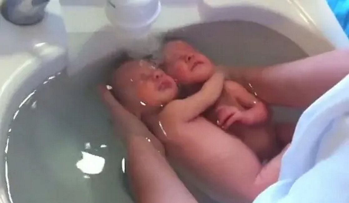 Nie wiedziały, że się urodziły. Niesamowite nagranie podbiło Internet