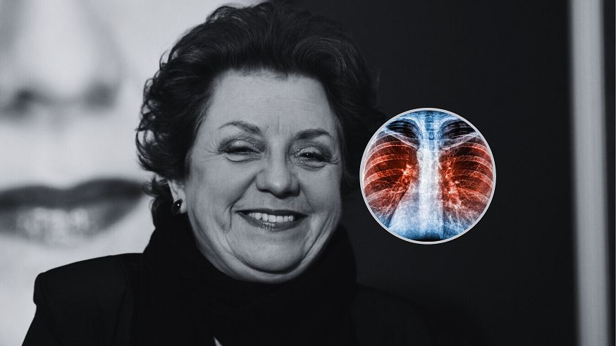 Śpiewaczka operowa przegrała z rakiem płuc. Tak atakuje nowotwór