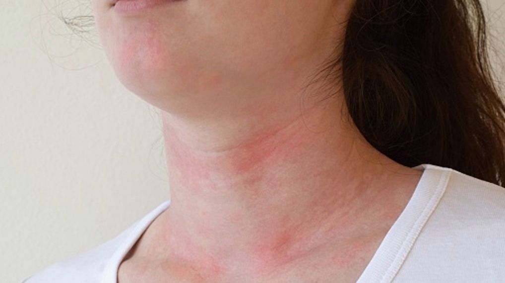 Omikron atakuje skórę i "zjada" kolagen? Eksperci wyjaśniają, co się zmieniło podczas V fali epidemii koronawirusa