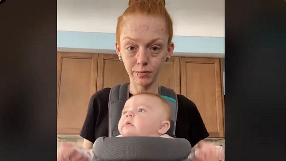 Ma zaledwie 22 lata. Za swój wygląd obwinia córkę