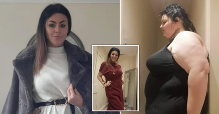 Usłyszała, że waga zagraża jej życiu. Po operacji zmniejszenia żołądka schudła ponad 100 kg