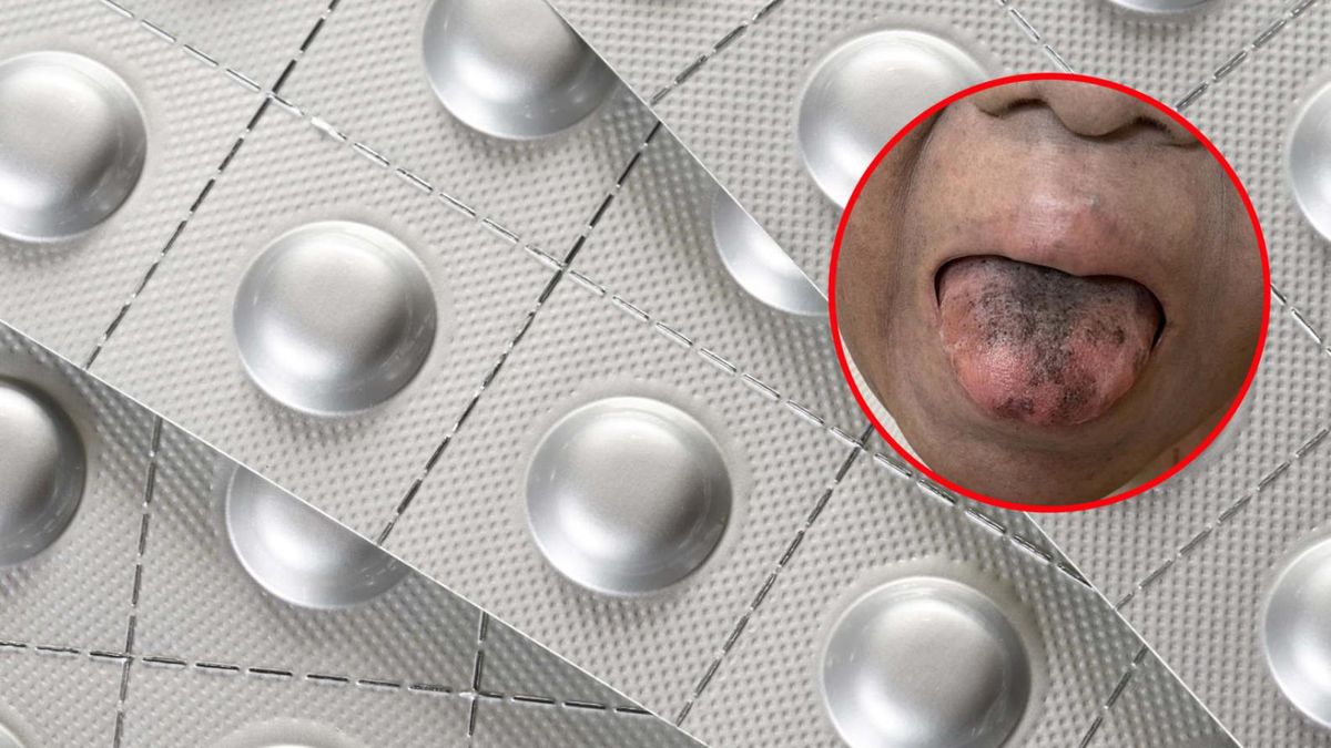 Antybiotyki mogą wywołać rzadkie reakcje