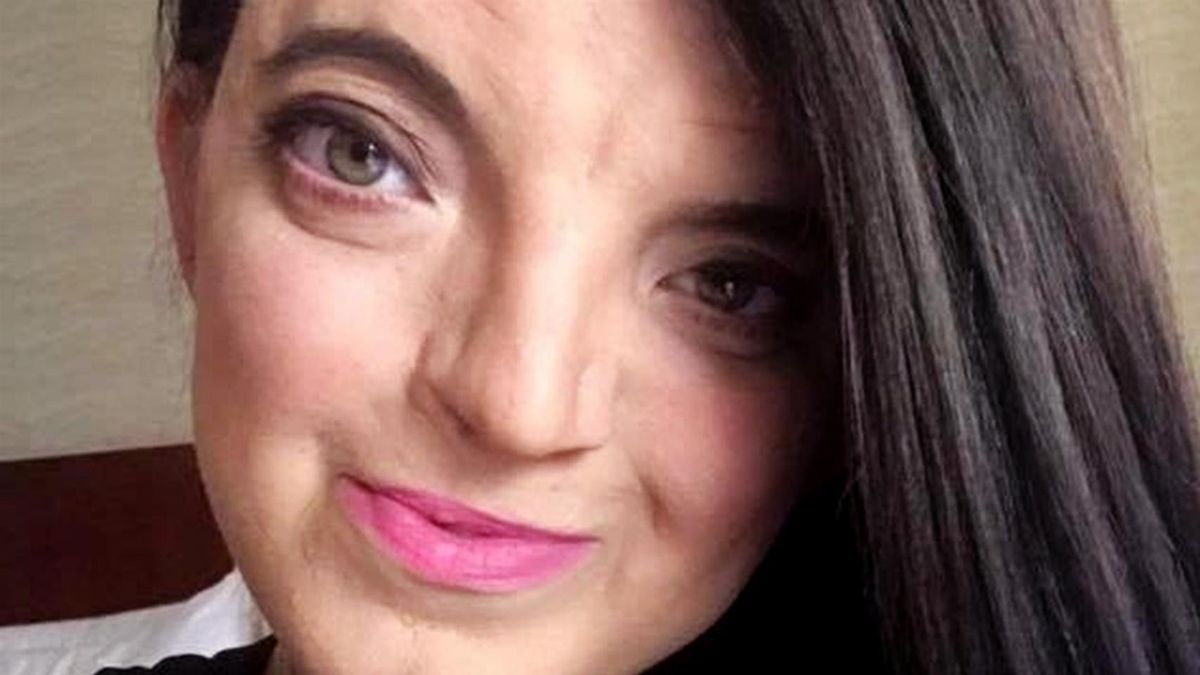 Rena Rosen urodziła się z deformacjami twarzoczaszki 