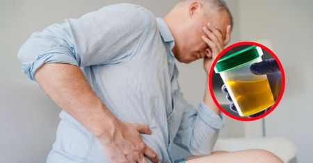Pierwszy objaw raka trzustki. Zwróć uwagę na ten szczegół