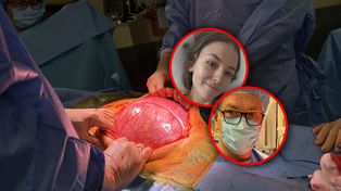 Kinga miała 15-kilogramowy guz jajnika. "Lekarz był przerażony"