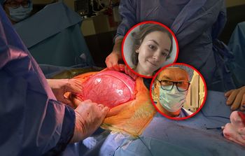 Kinga miała 15-kilogramowy guz jajnika. "Lekarz był przerażony"