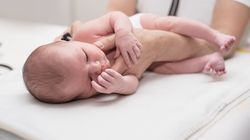 Gładkomózgowie (lizencefalia) - przyczyny, objawy i rokowanie