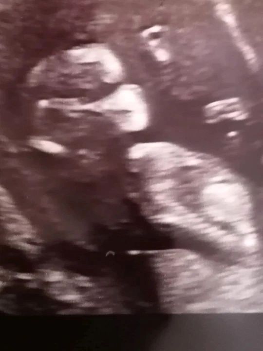 Zdjęcie dziecka Samanthy