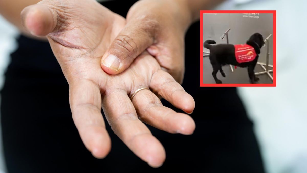 Psy mogą wykryć parkinsona