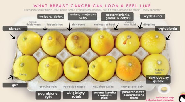 Erin Smith Chieze - 12 cytryn - objawy raka piersi