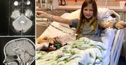 Dziewczynka miała guza mózgu, który nagle znikł. Niezwykłe uzdrowienie