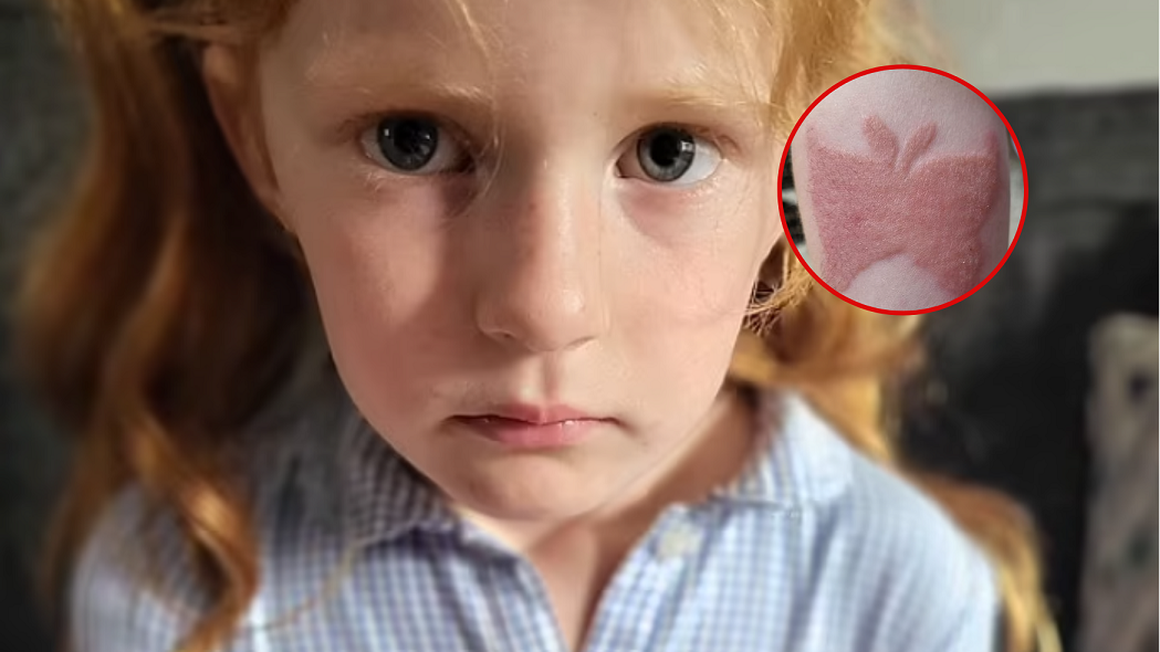 Tatuaż okazał się "blizną na całe życie". Matka 7-latki przestrzega rodziców