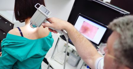 Wideodermatoskopia – na czym polega i kiedy ją wykonać?
