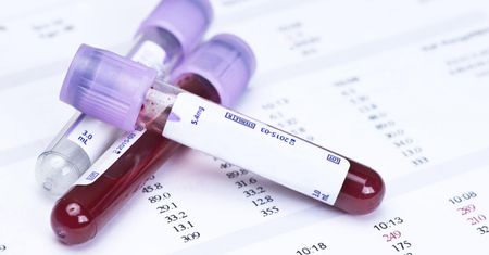 Badania laboratoryjne – jakie i kiedy warto wykonać?