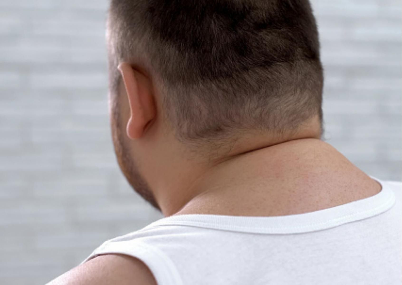 Wdowi garb dotyka także młodych 