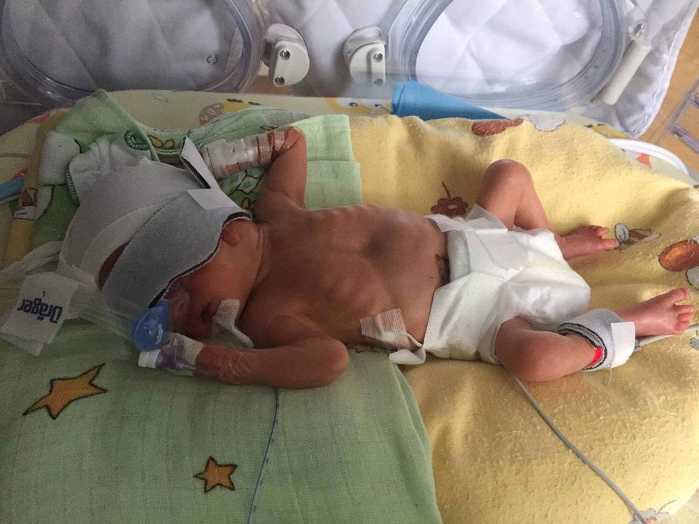 Franek tuż po urodzeniu. Ważył 1300 g